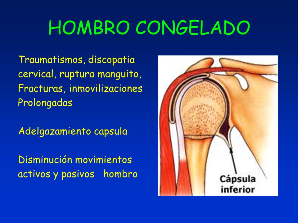 HOMBRO DOLOROSO , ENFOQUE DIAGNOSTICO Y TRATAMIENTO ppt HOMBRO DOLOROSO , ENFOQUE DIAGNOSTICO Y TRATAMIENTO ppt